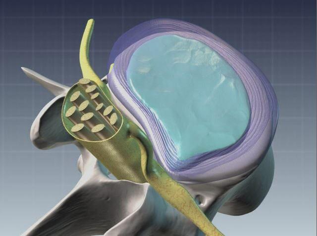 Schmerzen durch Nervenreizung