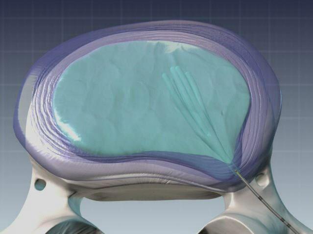 Segensreiche Innovation